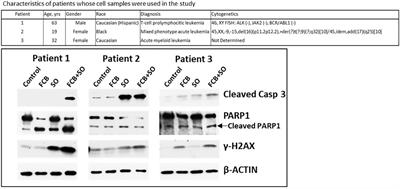 Synergistic cytotoxicity of fludarabine, clofarabine, busulfan, vorinostat and olaparib in AML cells